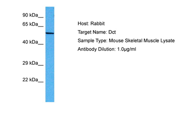 Dct Rabbit Polyclonal Antibody