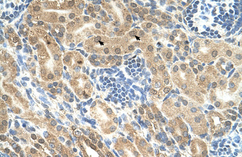 IHH Rabbit Polyclonal Antibody