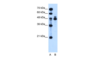 IHH Rabbit Polyclonal Antibody