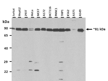 ITGB8 Rabbit Polyclonal Antibody