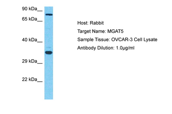 MGAT5 Rabbit Polyclonal Antibody
