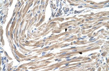 MGST2 Rabbit Polyclonal Antibody