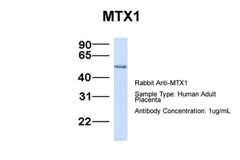 MTX1 Rabbit Polyclonal Antibody