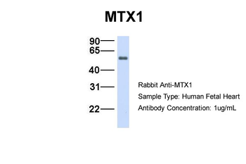 MTX1 Rabbit Polyclonal Antibody