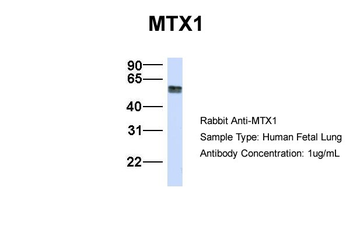 MTX1 Rabbit Polyclonal Antibody