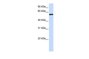 MTX1 Rabbit Polyclonal Antibody