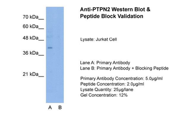 PTPN2 Rabbit Polyclonal Antibody