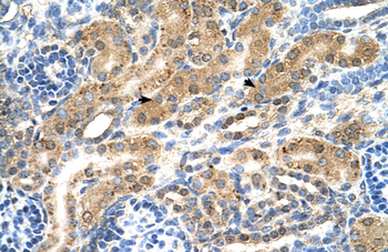 PTPN2 Rabbit Polyclonal Antibody