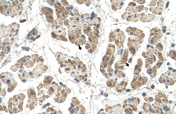 SSR2 Rabbit Polyclonal Antibody