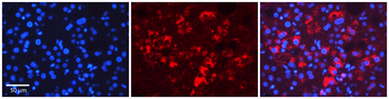 TAPBP Rabbit Polyclonal Antibody
