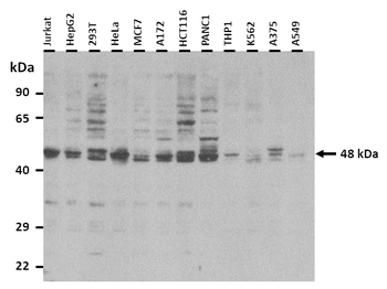 TAPBP Rabbit Polyclonal Antibody