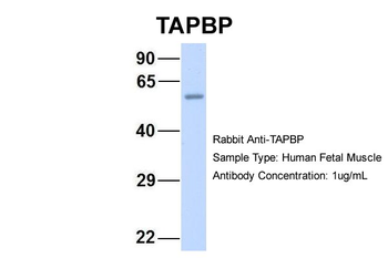 TAPBP Rabbit Polyclonal Antibody