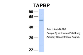 TAPBP Rabbit Polyclonal Antibody