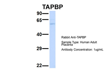 TAPBP Rabbit Polyclonal Antibody