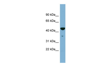 TAPBP Rabbit Polyclonal Antibody