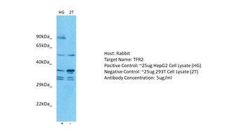 TFR2 Rabbit Polyclonal Antibody