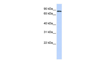 TFR2 Rabbit Polyclonal Antibody