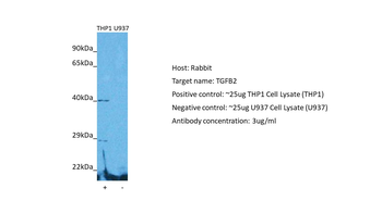 TGFB2 Rabbit Polyclonal Antibody