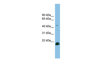 TGFB2 Rabbit Polyclonal Antibody