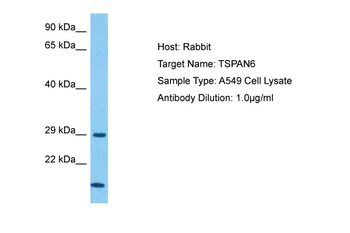 TSPAN6 Rabbit Polyclonal Antibody