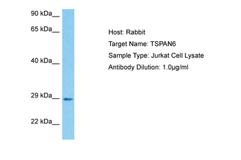 TSPAN6 Rabbit Polyclonal Antibody
