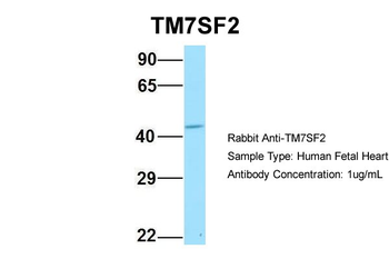 TM7SF2 Rabbit Polyclonal Antibody