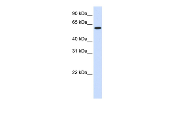 UGT8 Rabbit Polyclonal Antibody