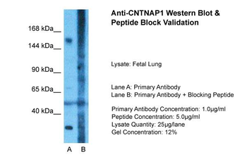 CNTNAP1 Rabbit Polyclonal Antibody