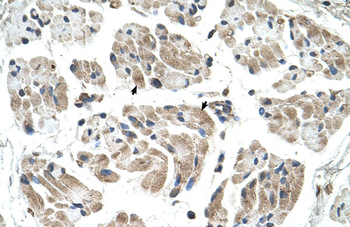 CHST1 Rabbit Polyclonal Antibody