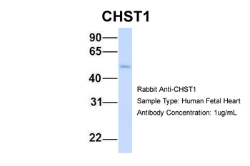 CHST1 Rabbit Polyclonal Antibody