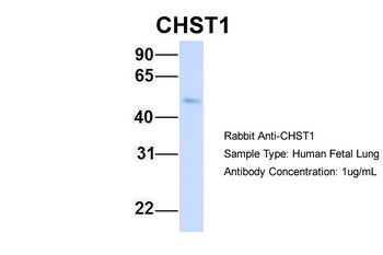 CHST1 Rabbit Polyclonal Antibody