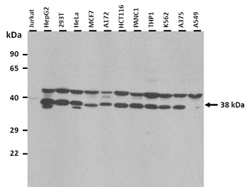 DEGS1 Rabbit Polyclonal Antibody
