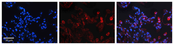 DEGS1 Rabbit Polyclonal Antibody