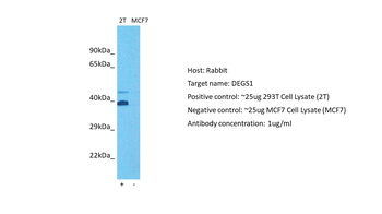 DEGS1 Rabbit Polyclonal Antibody