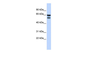GALNT4 Rabbit Polyclonal Antibody
