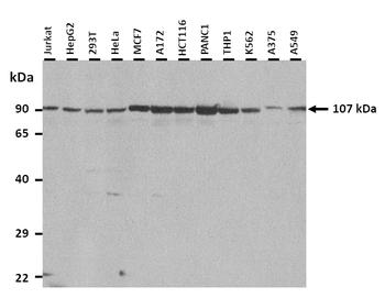 NR3C2 Rabbit Polyclonal Antibody