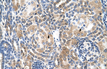 NR3C2 Rabbit Polyclonal Antibody