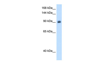 NR3C2 Rabbit Polyclonal Antibody