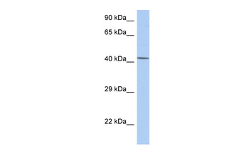 NR5A1 Rabbit Polyclonal Antibody