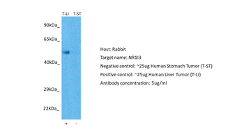 NR1I3 Rabbit Polyclonal Antibody