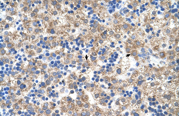 NR1I3 Rabbit Polyclonal Antibody