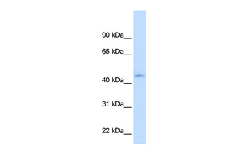 NR1I3 Rabbit Polyclonal Antibody