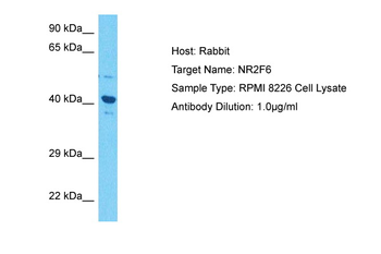 NR2F6 Rabbit Polyclonal Antibody