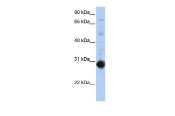 NR0B2 Rabbit Polyclonal Antibody