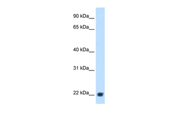KLKB1 Rabbit Polyclonal Antibody