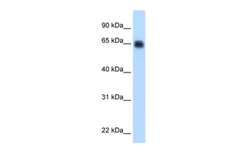 KNG1 Rabbit Polyclonal Antibody