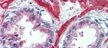 IGFBP4 Rabbit Polyclonal Antibody