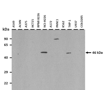 BAAT Rabbit Polyclonal Antibody