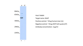 BAAT Rabbit Polyclonal Antibody