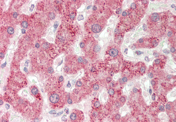 BAAT Rabbit Polyclonal Antibody